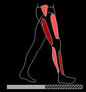 Cómo evitar que suceda: Estar despierto durante la cirugía a pesar de la anestesia (3)