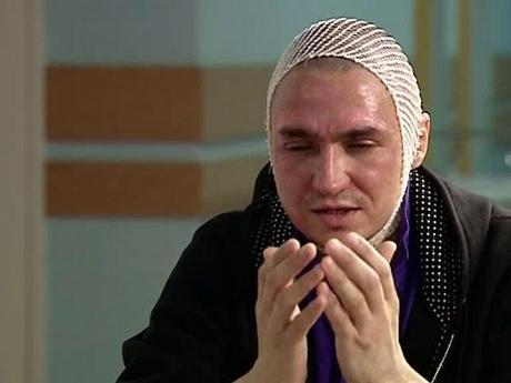 Pavel Dmitrichenko, solista del Bolshoi, confiesa el  ataque a Filin