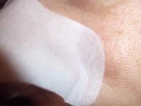 Skinmiso, tratamiento para poros y espinillas, Wishtrend