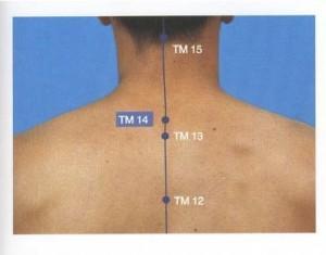 14 Du Mai. Punto de acupuntura situado en la depresión inferior de la apófisis espinosa C7. Despeja el calor y libera la superfície. Ideal en fiebres elevadas, resfriados, gripes y epilepsias.
