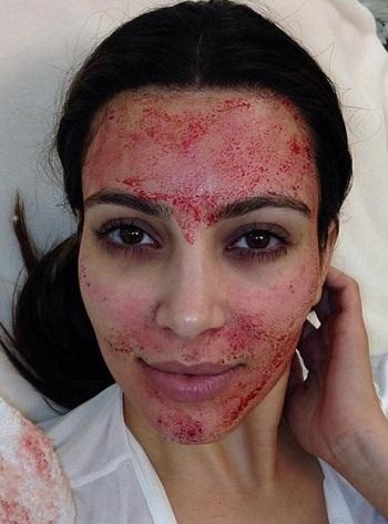 Kim Kardashian llena su rostro de sangre…