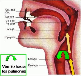 Por qué el paciente no debe comer ni beber poco antes de que lo operen [parte 3]