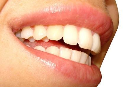 Consejos para tratar la sensibilidad dental Consejos para tratar la sensibilidad dental