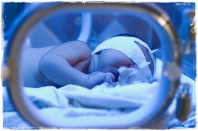 La ictericia en el recién nacido
