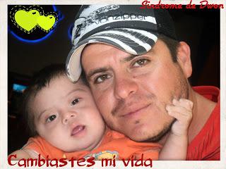 Tener Síndrome de Down