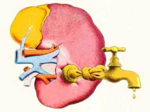 2,3 millones de españoles desconocen que padecen una insuficiencia renal