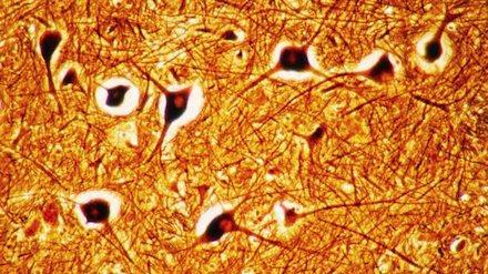 Nuevas células nerviosas encontradas en el cerebro