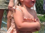 niñas vulnerables frente artritis reumatoide juvenil