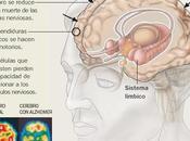 primeros problemas cognitivos enfermedad Alzheimer