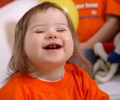 21 de Marzo: DÍA MUNDIAL DEL SÍNDROME DE DOWN