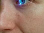 Advierten muchos quedan ciegos porque detecta glaucoma congénito tiempo