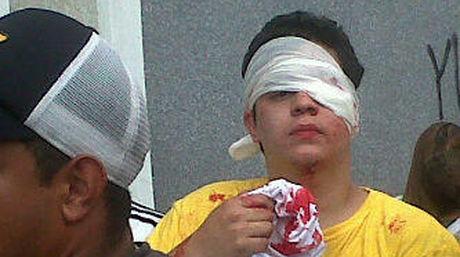 Estudiante herido en la marcha hacia el CNE / @ResistenciaV58