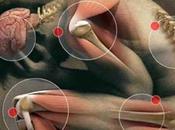 flotador fibromialgia