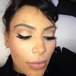 Kim Kardashian se relaja con agujas en su cara…