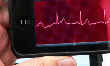 Un electrocardiograma con un telefono celular.