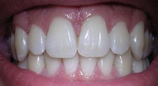 dientes-hacer-humanos