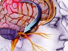 Consejos para aliviar trastorno migraña