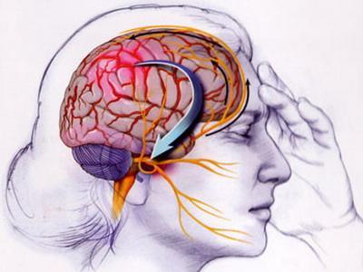 Consejos para aliviar el trastorno de la migraña Consejos para aliviar el trastorno de la migraña