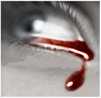 Volver desde… el molesto dolor
