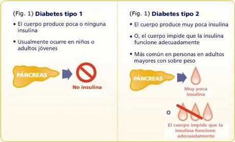 diabetes-tipo-2-Revertir la Diabetes