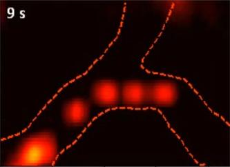 Nueva tecnica para la vigilancia radiologica individual de globulos rojos.