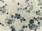 Avanzado Purificador Aire