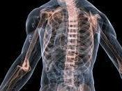 Osteoporosis Masculina