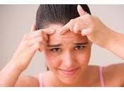 Isotretinoina (roacutan): mayor avance terapeutico dermatologia ultimos años