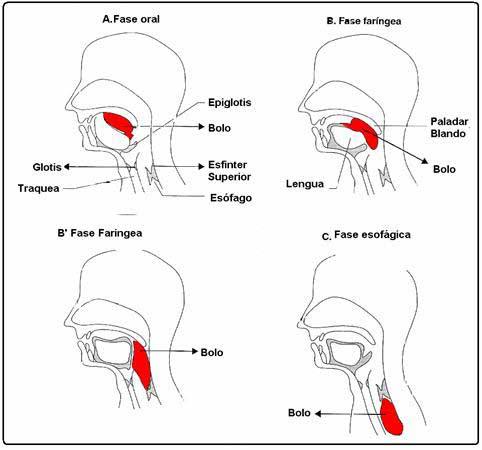 Disfagia en el daño cerebral adquirido