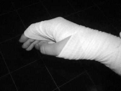 Tratamiento Síndrome del Túnel del Carpo