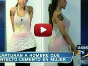 VIDEO Doctor inyectan cemento gluteos esta mujer.