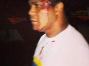 Chavistas atacan estudiantes venezuela