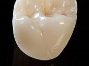 ☻¿por coronas dentales necesitan reemplazadas?