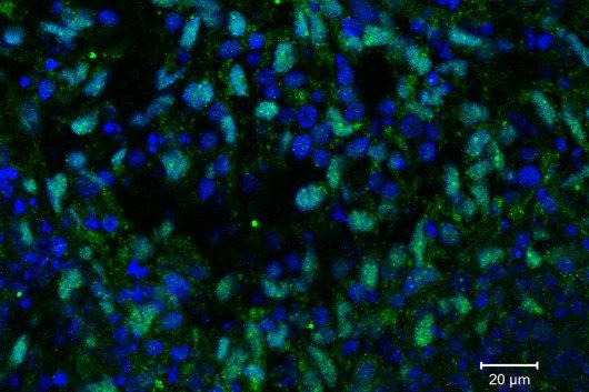 Retina artificial creada con células madre