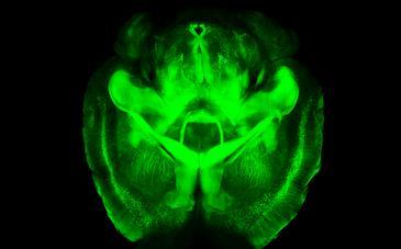 Un cerebro transparente muestra sus secretos