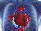 insuficiencia cardíaca