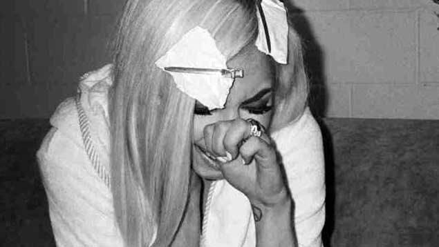 Lady Gaga no podrá regresar a los escenarios hasta septiembre