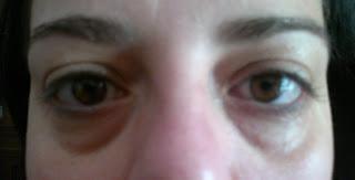 Skin & lab, K plus Red X Skin & lab, K plus Red X