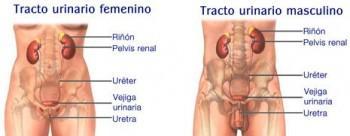 Hipersensibilidad e infección del tracto urinario