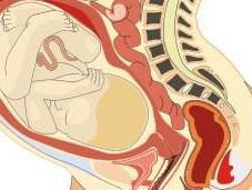 metabolismo madre limita duración embarazo