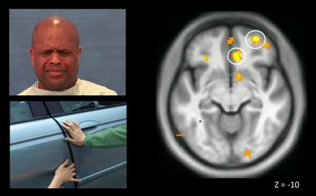 ¿Cómo funciona el cerebro de un psicópata?