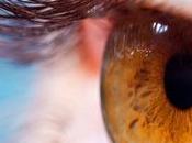 Todo sobre Glaucoma. Glaucoma como tratarlo.