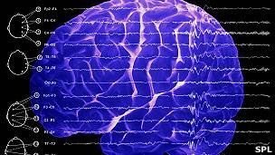 Mapear la actividad del cerebro humano. Proyecto Brain.