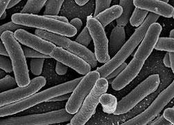 Escherichia-coli-UMF