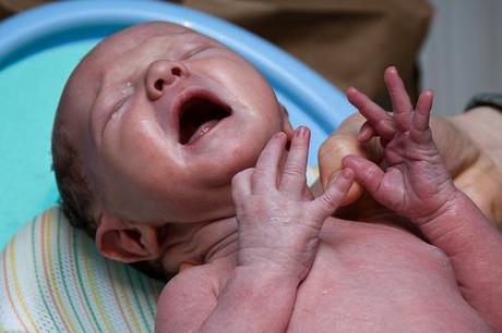 La dermatitis alérgica afecta al 5% de los bebés