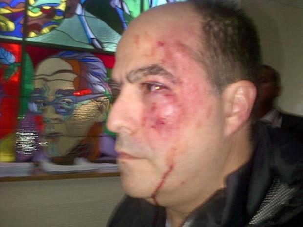 Julio Borges, agredido en el Congreso venezolano