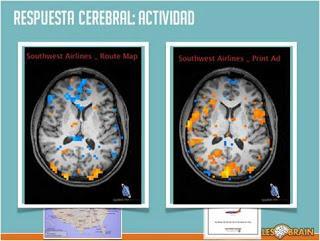 Respuesta cerebral a estímulos, Fmri, Antonio Casals, Esmeralda Diaz-Aroca