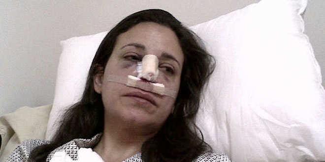 OPERADA MARIA CORINA TRAS BRUTAL ATAQUE