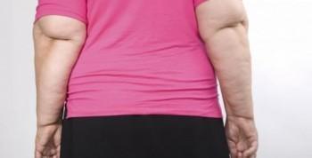 Las mujeres con sobrepeso y obesidad tienen un mayor riesgo de artritis reumatoide