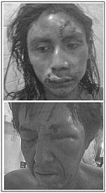 La violencia contra la comunidad Qom, y las hilachas de una pronunciación incorrecta